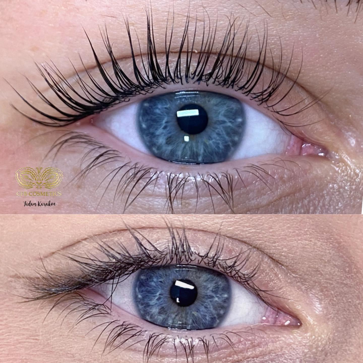 Wimpernlifting