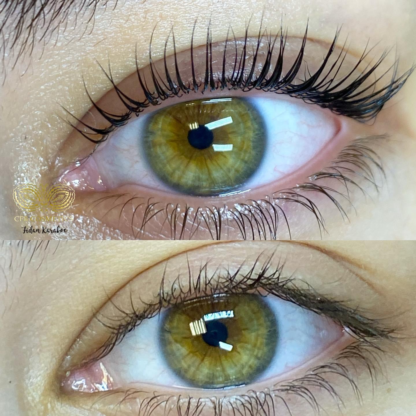 Wimpernlifting