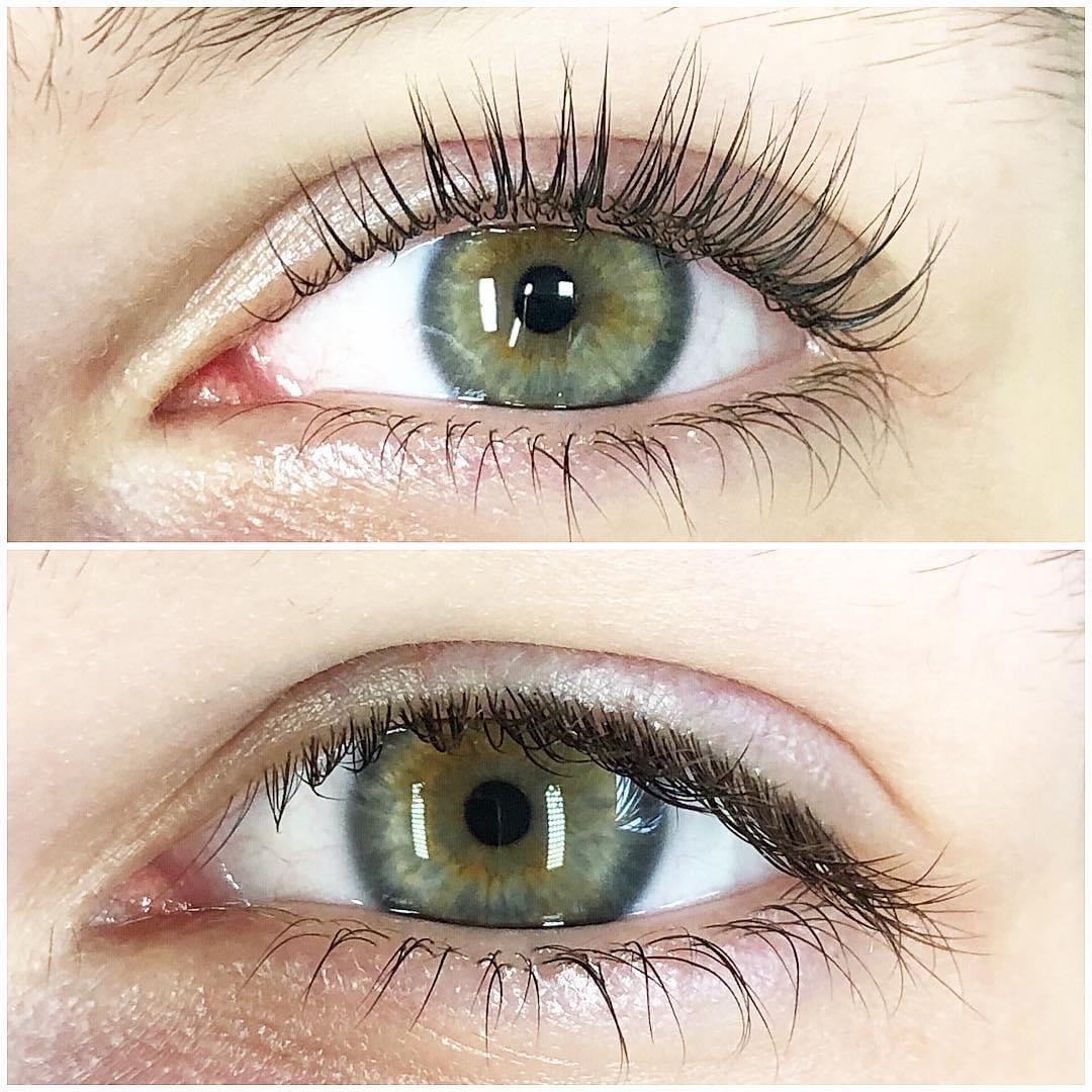 Wimpernlifting
