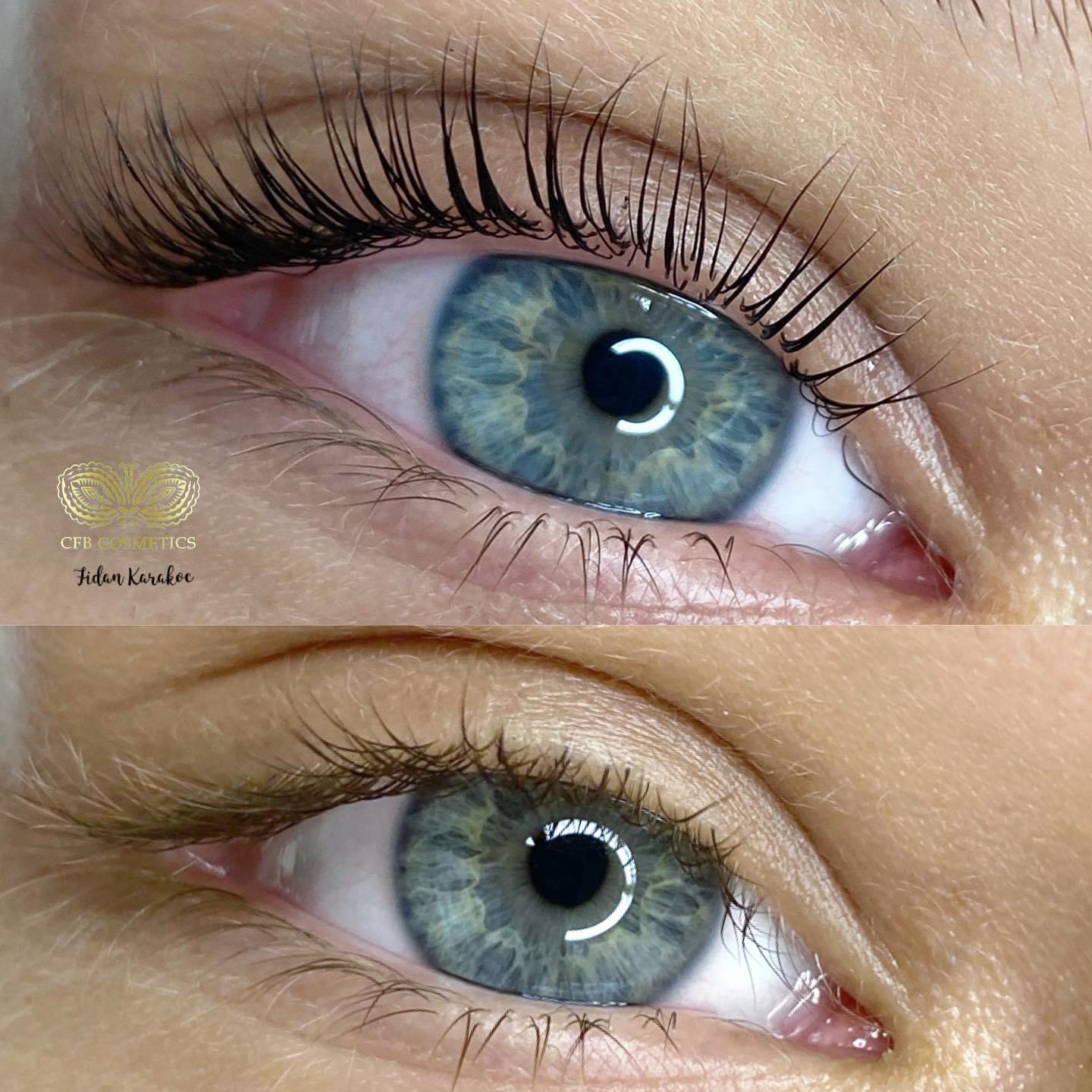 Wimpernlifting