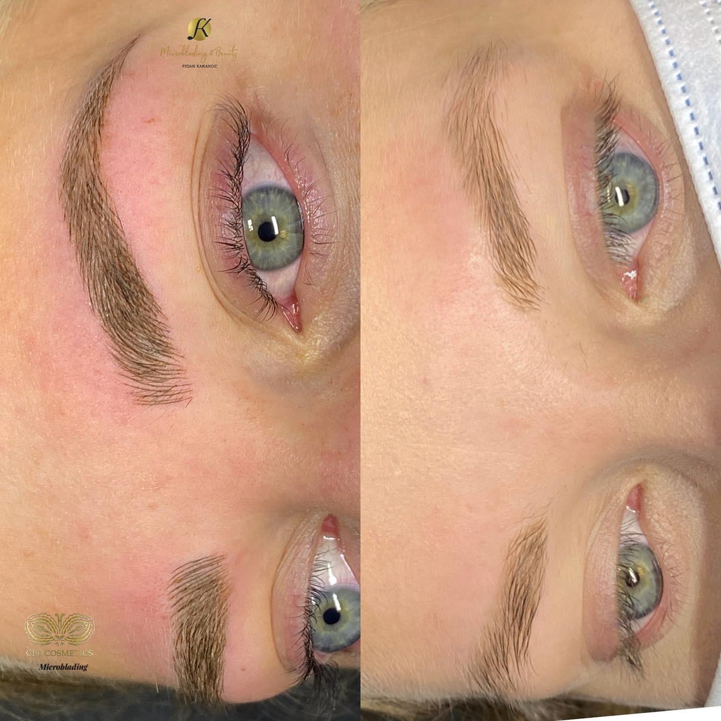 Microblading