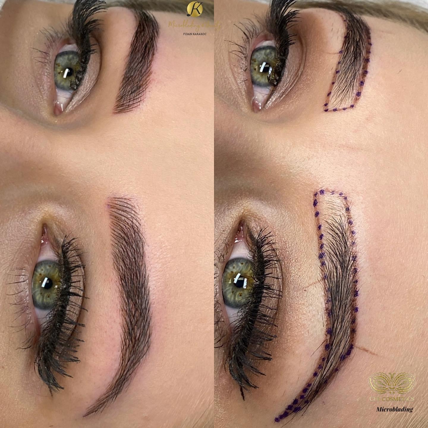 Microblading